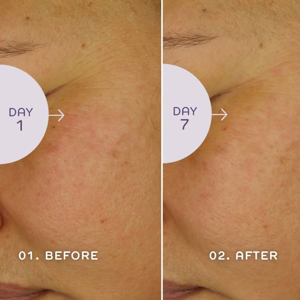 REN Clean Skincare Bio Retinoid Youth Serum - Picture 3 of 6